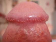 54