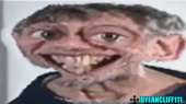 72