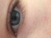 532