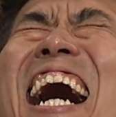 72