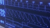 1280x720