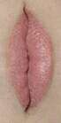 69x139