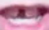 179x111