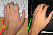 460x305