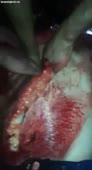 400x736