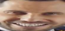 636x311