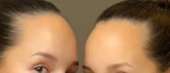 601x260