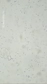 576x1024