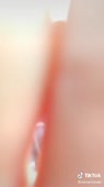 576x1024