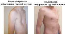 1200x630