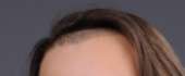 572x238
