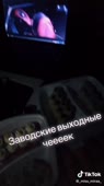 540x960