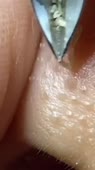 576x1024