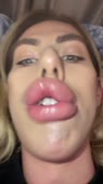 576x1024