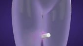 460x256