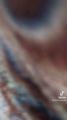 576x1024