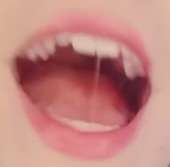 336x332