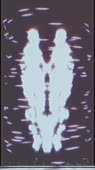 576x1024