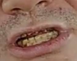 701x561