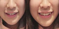 588x294