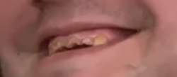 336x149