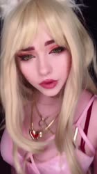 720x1280