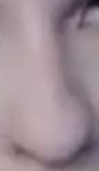 300x518