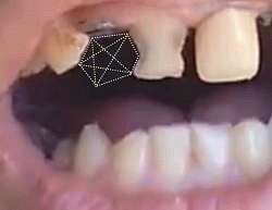 666x515