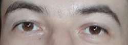 500x178
