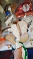 720x1280