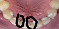 400x196