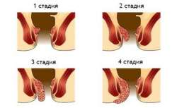 600x369